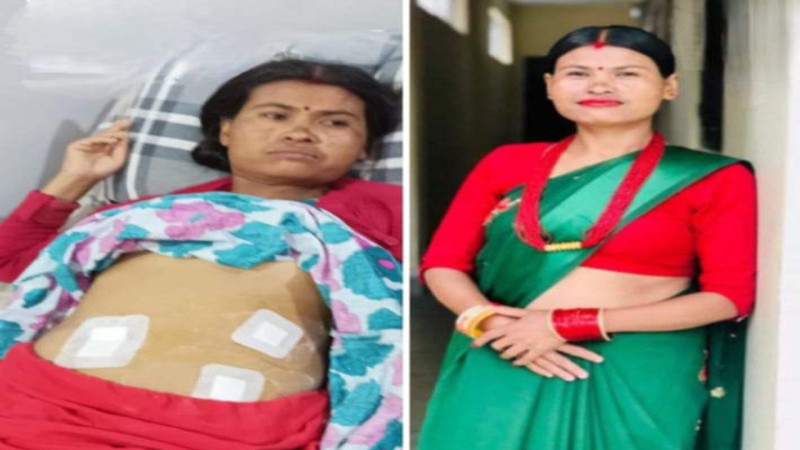 मृगौलापीडित विन्दु चौधरीको उपचारमा सहयोगका लागि अपिल